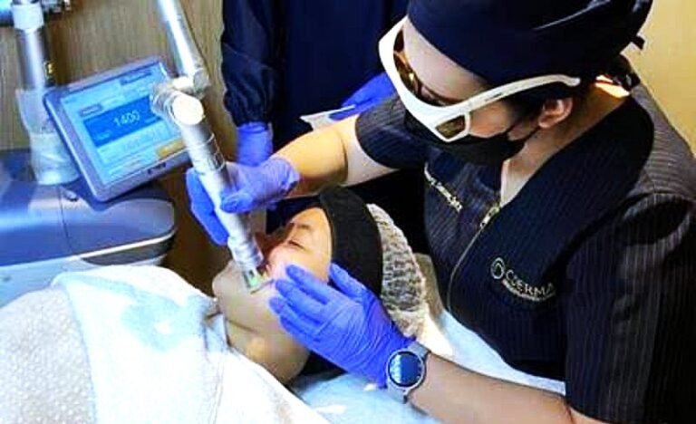 Vitiligo C Derma